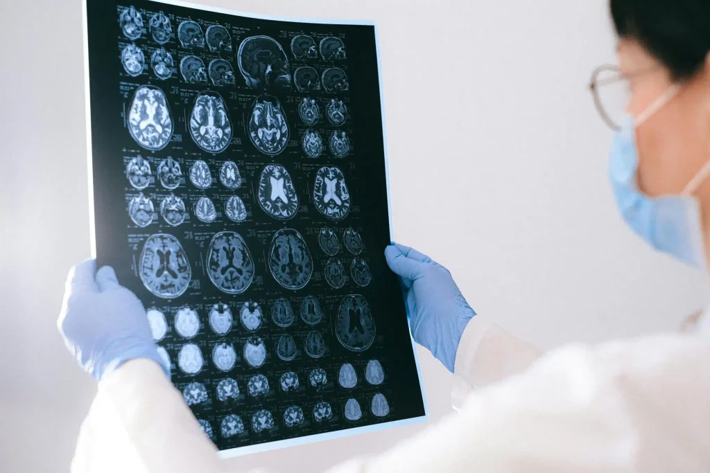A doctor in gloves and a mask holds up a brain scan observing what does ketamine do to the brain.